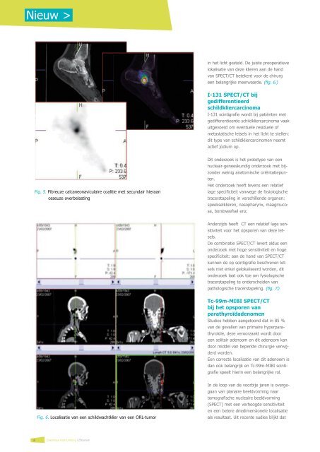 Nieuw: SPECT/CT in het ZOL