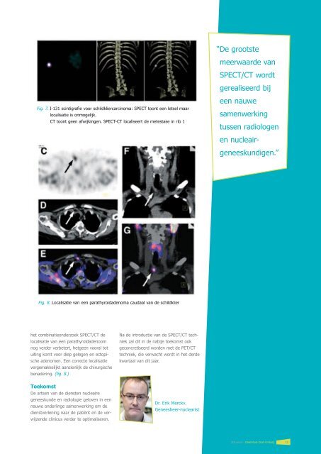 Nieuw: SPECT/CT in het ZOL