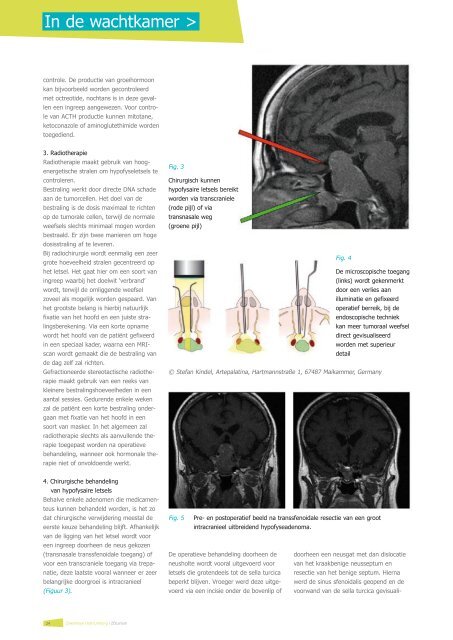 Nieuw: SPECT/CT in het ZOL