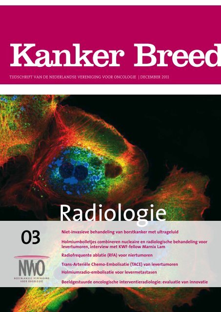 Radiologie - Nederlandse Vereniging voor Oncologie
