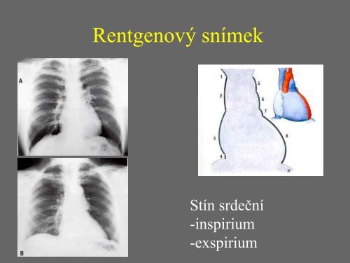 Sd - Anatomický ústav 1.LF UK - Univerzita Karlova