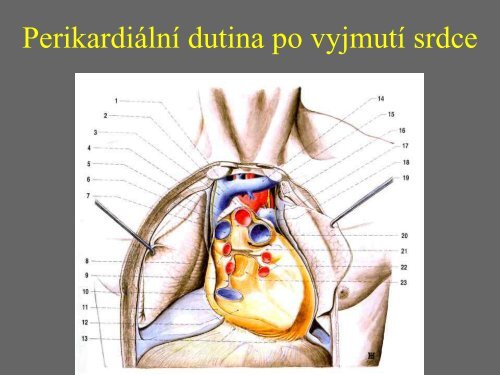 Sd - Anatomický ústav 1.LF UK - Univerzita Karlova