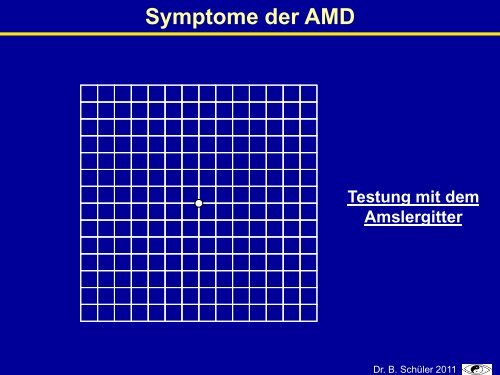 Naturheilverfahren Bei Makuladegeneration - Natur und Medizin e.V.