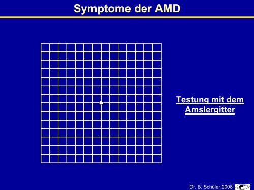 Epidemiologie der altersbedingten Makuladegeneration (AMD)