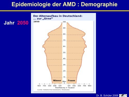 Epidemiologie der altersbedingten Makuladegeneration (AMD)