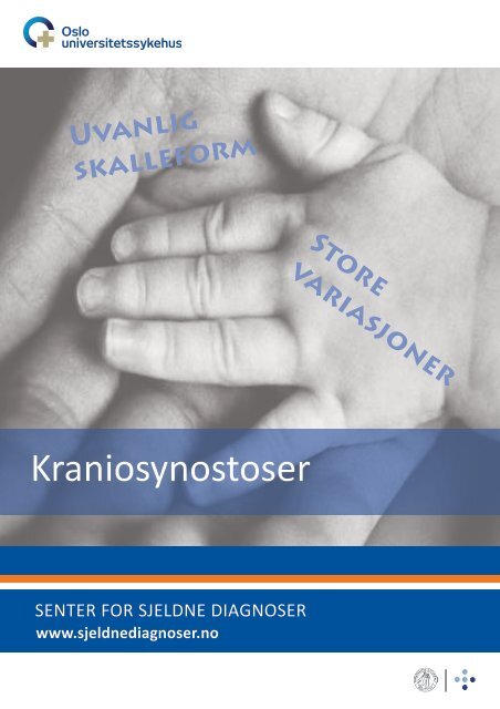 Kraniosynostoser (pdf) - Senter for sjeldne diagnoser