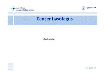 6 Cancer øsofagi alm