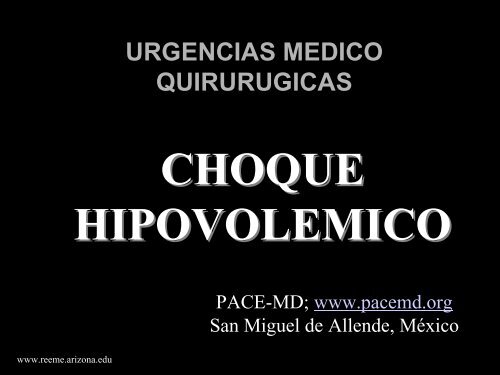 Choque Hipovolemico