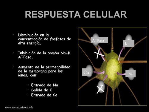 Choque Hipovolemico