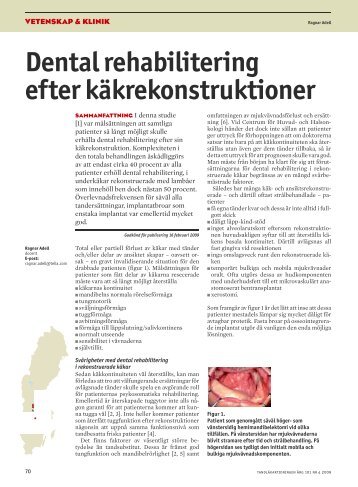 Dental rehabilitering efter käkrekonstruktion - Tandläkartidningen