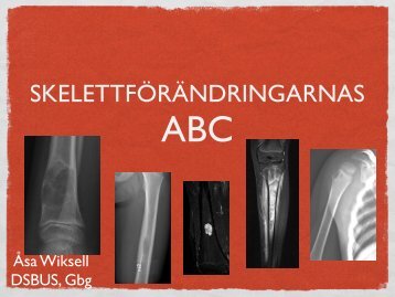 SKELETTFÖRÄNDRINGARNAS