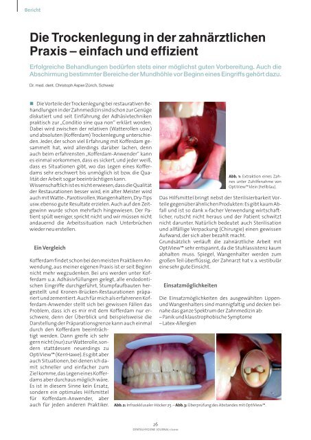 OptiView Dr. Asper Schweiz.pdf - Kerrdental.de