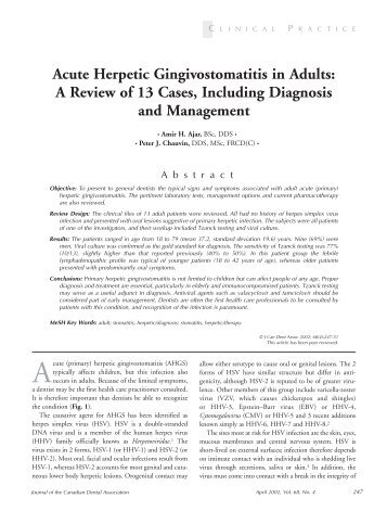 Acute Herpetic Gingivostomatitis in Adults - Canadian Dental ...