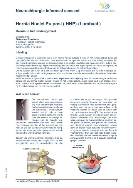 Hernia Nuclei Pulposi ( HNP)-(Lumbaal )