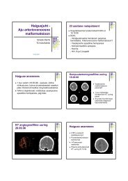 Haigusjuht - Aju arteriovenoosne malformatsioon