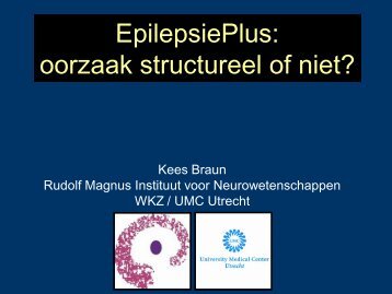 EpilepsiePlus, oorzaak structureel of niet - Epilepsie Vereniging ...