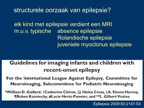 EpilepsiePlus, oorzaak structureel of niet - Epilepsie Vereniging ...