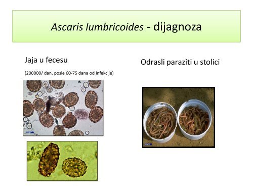 Crevni helminti čoveka - Medicinski fakultet - Univerzitet u Beogradu