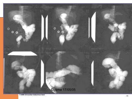 Pediatrische abdominale urgenties - Surgery.ugent.be