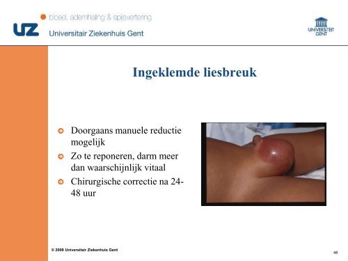 Pediatrische abdominale urgenties - Surgery.ugent.be