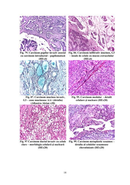 cercetări histologice şi imunohistochimice în ... - "Gr.T. Popa" Iasi