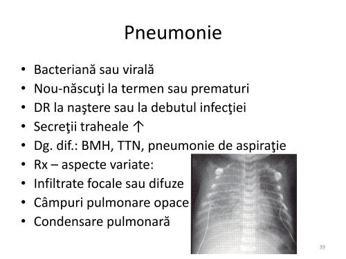 Stabilizarea pre-transport a nou-născuţilor - Gr.T. Popa