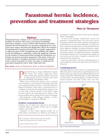 Parastomal hernia: incidence, prevention and treatment strategies