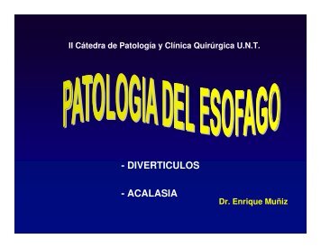 - DIVERTICULOS - ACALASIA