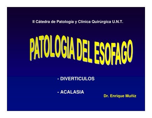 - DIVERTICULOS - ACALASIA