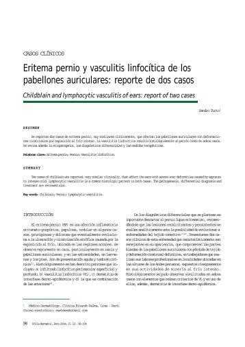 Eritema pernio y vasculitis linfocítica de los pabellones auriculares ...