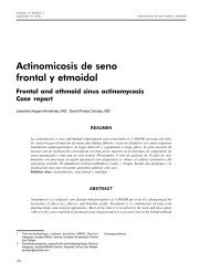 Actinomicosis de seno frontal y etmoidal - ACORL