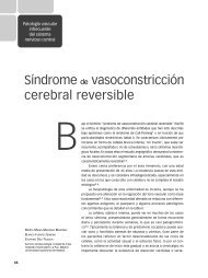 Síndrome de vasoconstricción cerebral reversible - Grupo de ...
