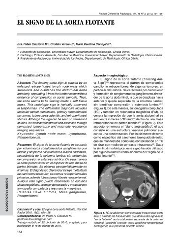 EL SIGNO DE LA AORTA FLOTANTE - SciELO
