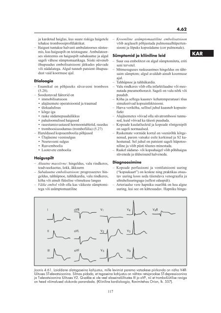 4. 4. SÜDAME- JA VERESOONKONNAHAIGUSED