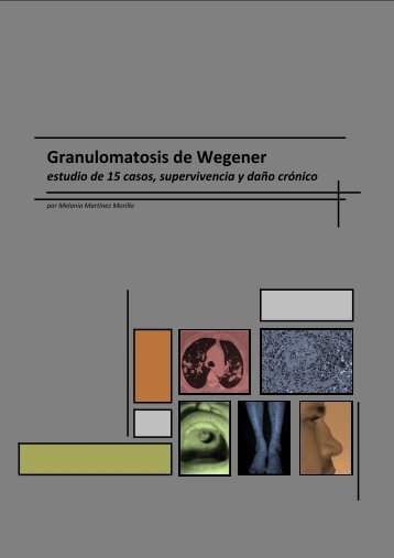 Granulomatosis de Wegener - Recercat