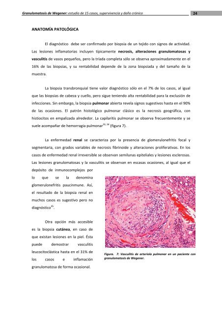 Granulomatosis de Wegener - Recercat