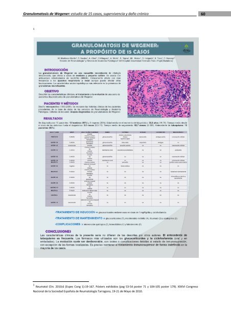 Granulomatosis de Wegener - Recercat