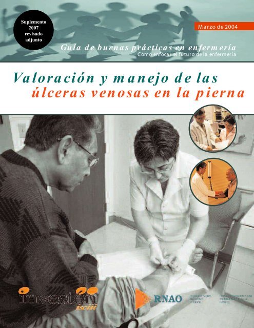 Valoración y manejo de las úlceras venosas en - Registered Nurses ...