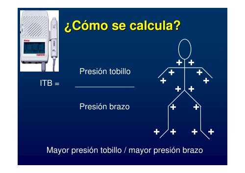 El Indice Tobillo/Brazo (ITB) - Telecardiologo.com