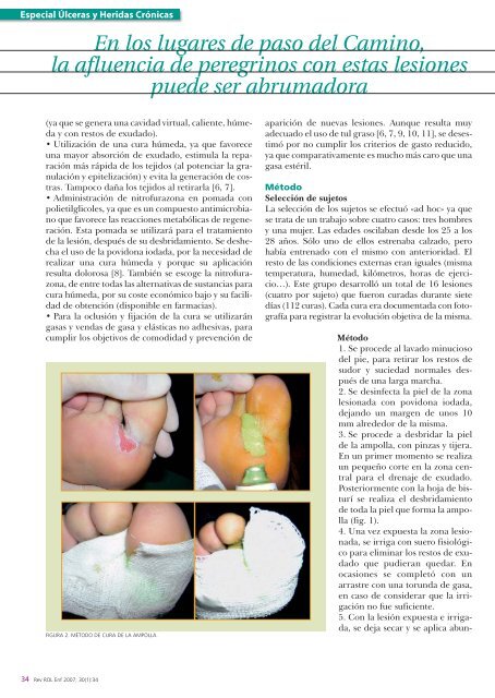 Cura de ampollas por fricción - Rol