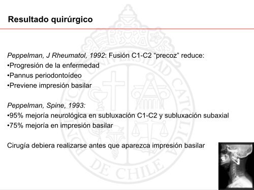 Artritis Reumatoide cervical. Tratamiento quirúrgico