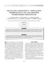 NEVUS AZUL PROSTÁTICO. UNIFICACIÓN TERMINOLÓGICA DE ...