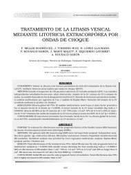 TRATAMIENTO DE LA LITIASIS VESICAL MEDIANTE LITOTRICIA ...