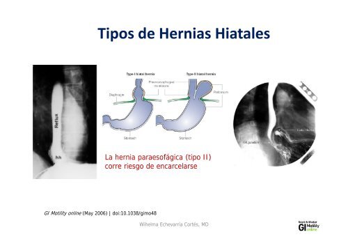 Condiciones Esofágicas Condiciones Esofágicas ... - Alape