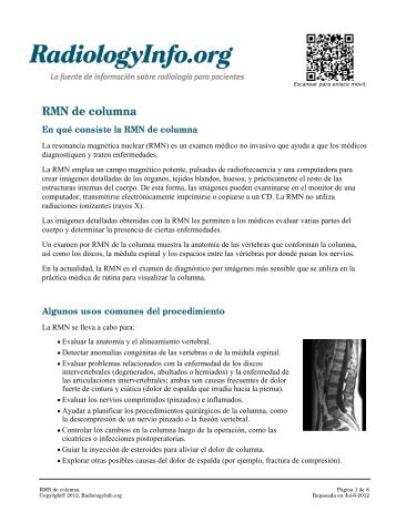 RMN de columna - RadiologyInfo
