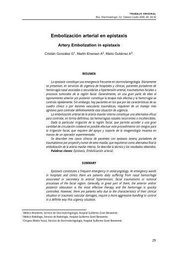 Embolización arterial en epistaxis