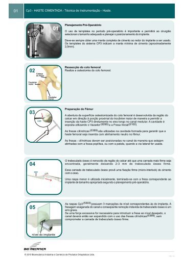 T017 - Técnica Cirurgica CP3 - HASTE - REV04.cdr - Biomecanica