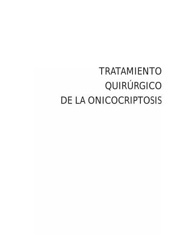 tratamiento quirúrgico de la onicocriptosis - Clinica del Pie ...