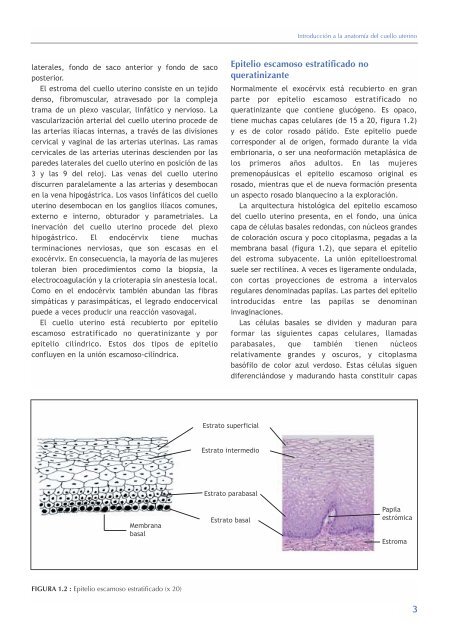 La colposcopia y el tratamiento de la neoplasia intraepitelial cervical: