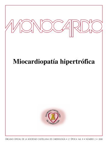 Miocardiopatía hipertrófica - Sociedad Castellana de Cardiología